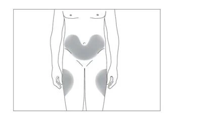 Schematic drawing of a human body showing dark gray areas on