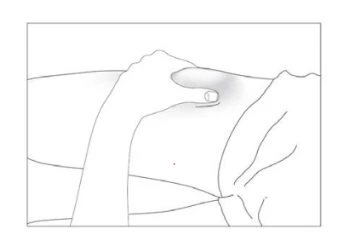 Line drawing of a hand pressing with fingers on the skin of the
