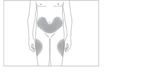 Schematic of the human body highlighting in gray the areas of