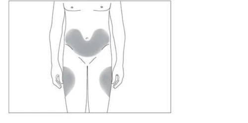Schema del corpo umano con aree grigie che indicano le zone di applicazione sull'addome e sulla parte superiore delle cosce