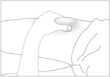 A hand grasping the skin of the