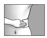 Schematic drawing of a hand applying a bandage or medical device to the abdominal area of a human torso