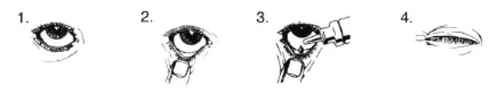 Sequence of four drawings showing the