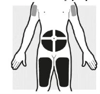 Human body diagram indicating drug administration sites on the
