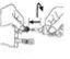 Technical drawing showing two hands joining components of a medical device following the direction indicated by the black arrows