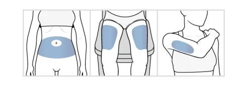 Three diagrams show application sites on abdomen, back, and upper arm, highlighted by blue spots on stylized human figures