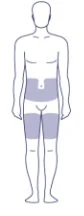 Diagramma di un corpo umano stilizzato con aree evidenziate in grigio sulla zona dell'addome e sulla parte superiore delle cosce