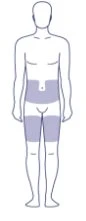 Anatomical diagram of the male human body with areas highlighted in purple on the