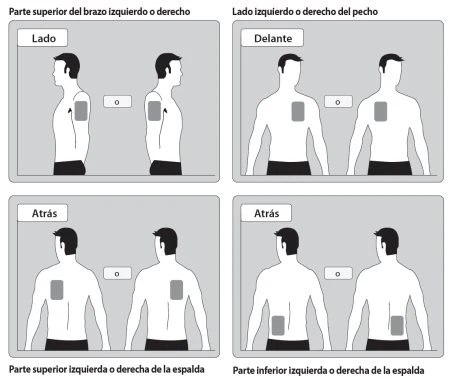 Medical diagram with four panels showing stylized human figures indicating injection sites on the arm, chest, and back