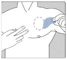 Schematic drawing of a male torso with a hand pointing to the chest area