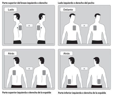 Diagramma medico con quattro riquadri che mostrano i punti di iniezione su braccio, petto e schiena di un uomo in diverse posizioni e angolazioni
