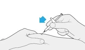 Una mano tiene una siringa con ago e la punta viene inserita sotto la pelle di un braccio con una freccia azzurra che indica il movimento