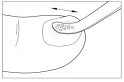 Disegno tecnico che mostra un applicatore che massaggia una zona circolare sulla pelle con un movimento avanti e indietro indicato da una freccia