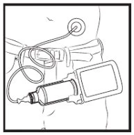 Disegno lineare di un dispositivo medico collegato a un sensore applicato sulla vita di una persona tramite un cavo sottile