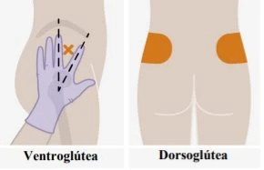 Medical diagram showing two areas for intramuscular injections on the buttock: ventrogluteal with angle indication, and dorsogluteal with orange-marked zones