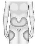 Diagram of the male human body highlighting the areas of drug application on the