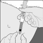 Una mano tiene una penna iniettore per somministrare il farmaco sulla pelle dell'addome mentre l'altra mano stabilizza la zona con le dita