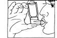 Black and white drawing showing a hand holding an inhaler near the mouth of a person for administration of medication