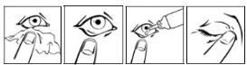Sequence of four drawings showing how to apply eye drops: pull down the eyelid, look up, and pour the liquid into the eye