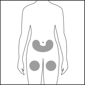 Schematic of the human torso with three gray areas indicating application sites on the lower part of the