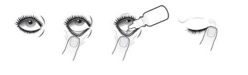 Sequence of four drawings showing how to apply eye drops by pulling down the lower eyelid and then closing the eye