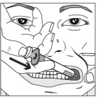 Disegno in bianco e nero che mostra una mano che tiene una siringa e la inserisce delicatamente all'interno della bocca aperta di una persona