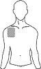 Line drawing of a male torso with a dashed circle indicating the area of drug application