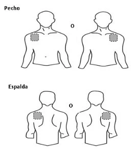 Diagramma medico con quattro figure umane stilizzate che mostrano aree tratteggiate sul petto e sulla schiena per indicare i siti di iniezione