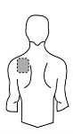 Stylized drawing of a person's torso with a dashed circle indicating the application area on the upper left back