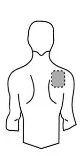 Stylized schematic of a man's torso viewed from behind, with a gray dashed circle applied to the upper right shoulder