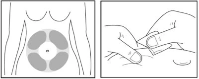 Diagram showing four circular gray areas on the body indicating recommended injection sites