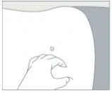 Disegno stilizzato di una mano che pizzica la pelle dell'addome sopra l'ombelico per preparare l'area all'iniezione