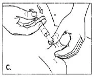 Due mani impugnano una siringa per iniettare il liquido nel gluteo di una persona