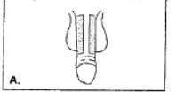 Disegno schematico in bianco e nero che mostra una sezione trasversale di un organo con due strati verticali paralleli e una base arrotondata