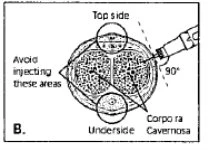 Diagramma medico che mostra un pene con indicazioni per l