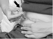 Una mano impugna una siringa per iniettare il farmaco nell'