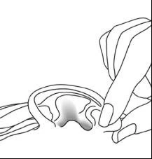 Disegno a linee nere che mostra una mano che preme delicatamente sulla parte superiore di un dispositivo medico circolare e piatto