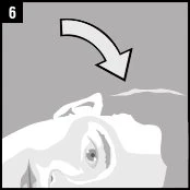 Medical illustration with a curved arrow indicating the direction of movement toward the top of a person's head