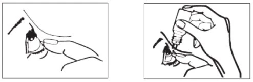 Black and white drawing showing a hand holding the eyelid open and