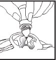 Disegno schematico in bianco e nero che mostra l'inserimento di un dispositivo medico in una cavità anatomica del corpo umano