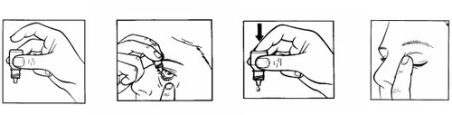 Sequence of four drawings showing how to hold the bottle and apply a drop into the eye