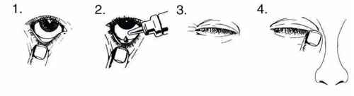 Four-step diagram showing how to apply eye drops: the