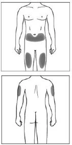 Diagramma del corpo umano che mostra le aree di iniezione evidenziate in grigio sull'addome, sulle cosce, sulle spalle e sulla parte superiore della schiena