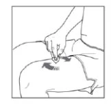 Disegno lineare di una mano che preme un dispositivo medico sulla parte superiore dell'addome con frecce che indicano il movimento verso il basso