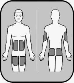 Diagramma medico che mostra la vista frontale e posteriore di un corpo umano con aree scure evidenziate sull'addome, sulle cosce, sulle braccia e sulla schiena
