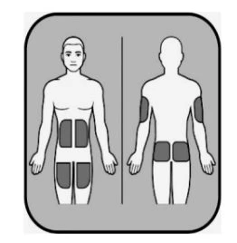 Medical diagram showing two human figures, one frontal and one posterior, with dark rectangular areas applied on the