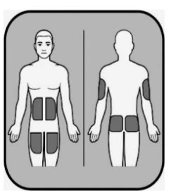 Diagramma medico che mostra un corpo umano visto di fronte e di schiena con aree grigie evidenziate sull'addome, sulle cosce e sulle braccia