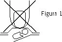 Schematic diagram with a large cross over a drawing showing an object pressing against a curved surface with a separation line