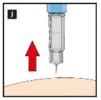 Medical illustration of a syringe with needle pointing toward the skin with a red arrow pointing downward
