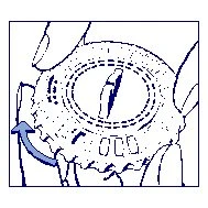 Disegno tecnico che mostra una mano che ruota un dispositivo medico circolare con una freccia blu che indica il movimento rotatorio verso sinistra
